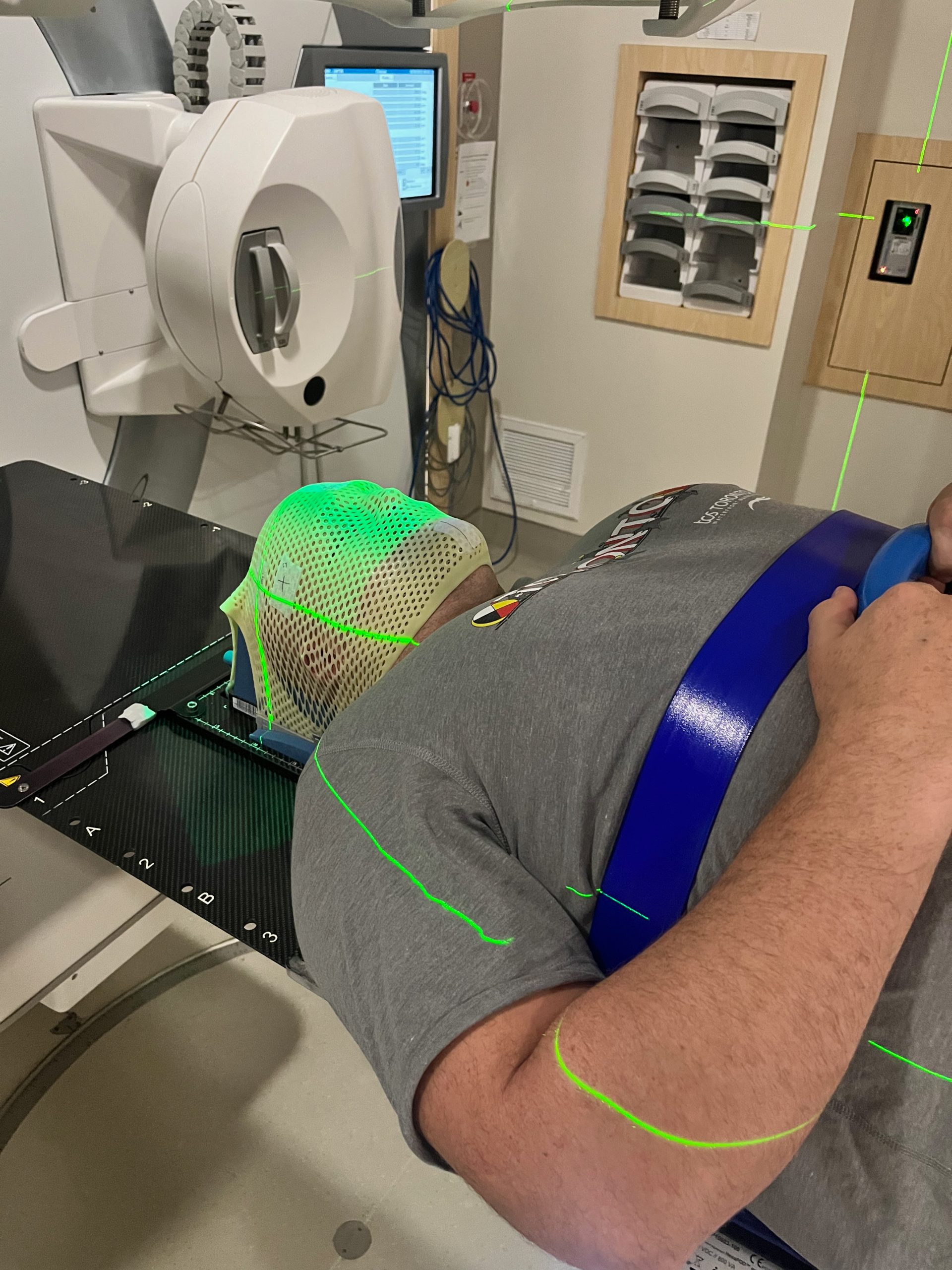 Radiation therapy at Odette Cancer Center, Sunnybrook Hospital, Toronto